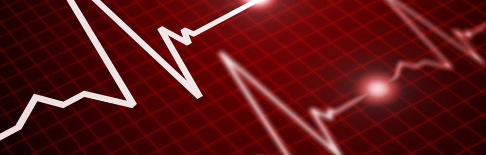 Heart Monitor Heart Monitor